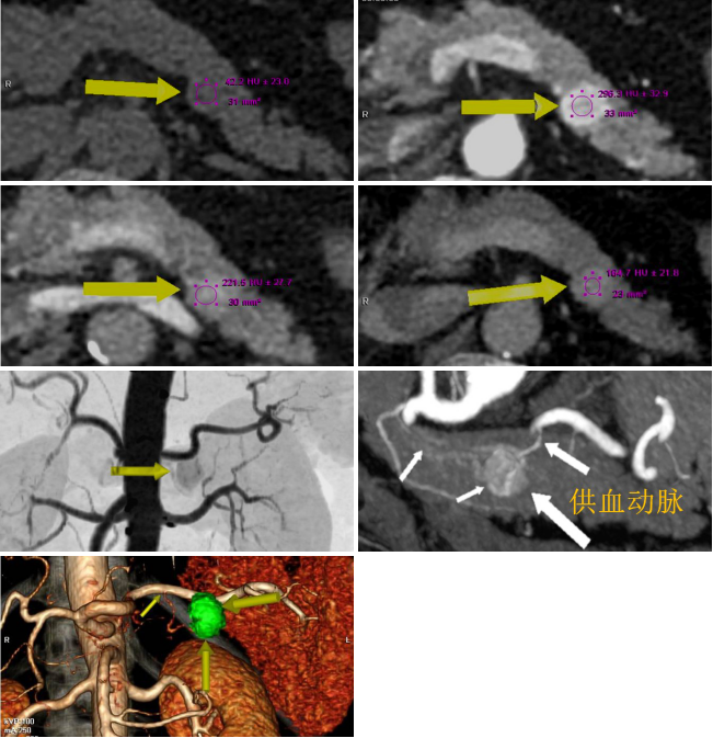 圖片22.png 圖片22.png