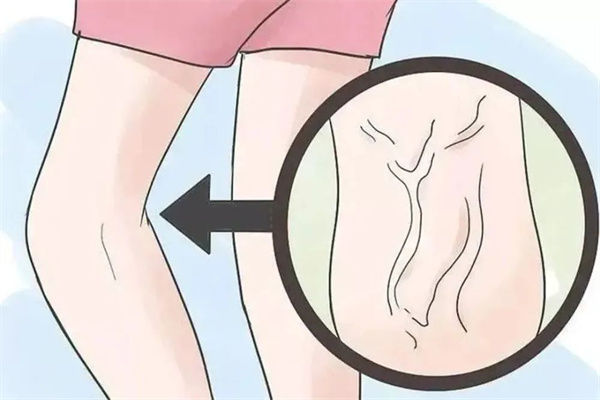 640 (11).jpg 640 (11).jpg