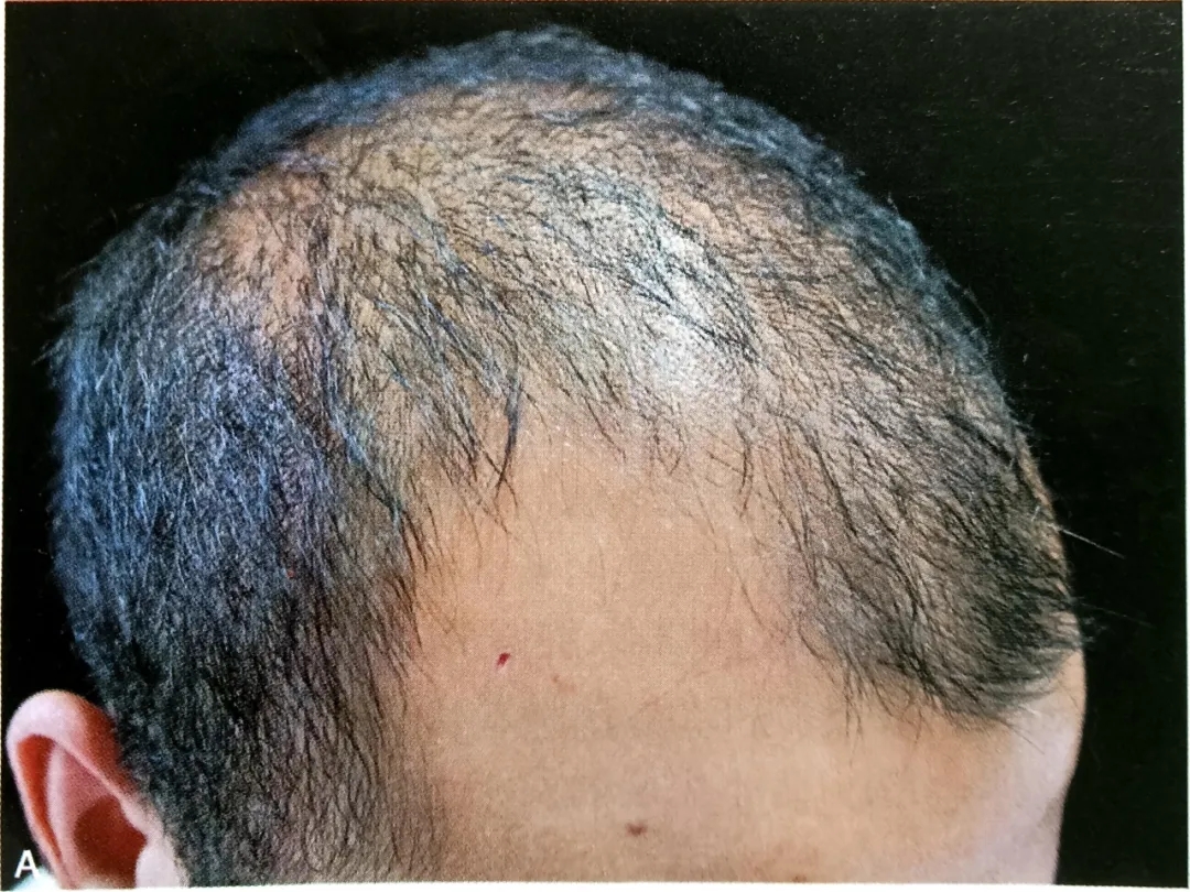 640.webp (1).jpg 640.webp (1).jpg