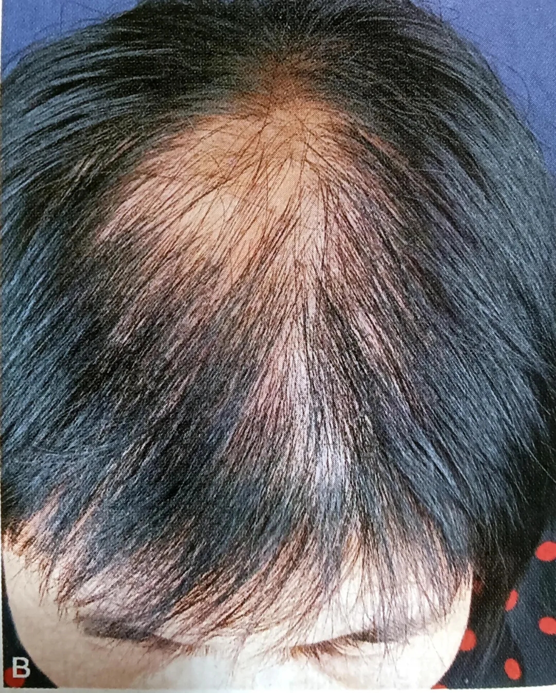 640.webp (2).jpg 640.webp (2).jpg