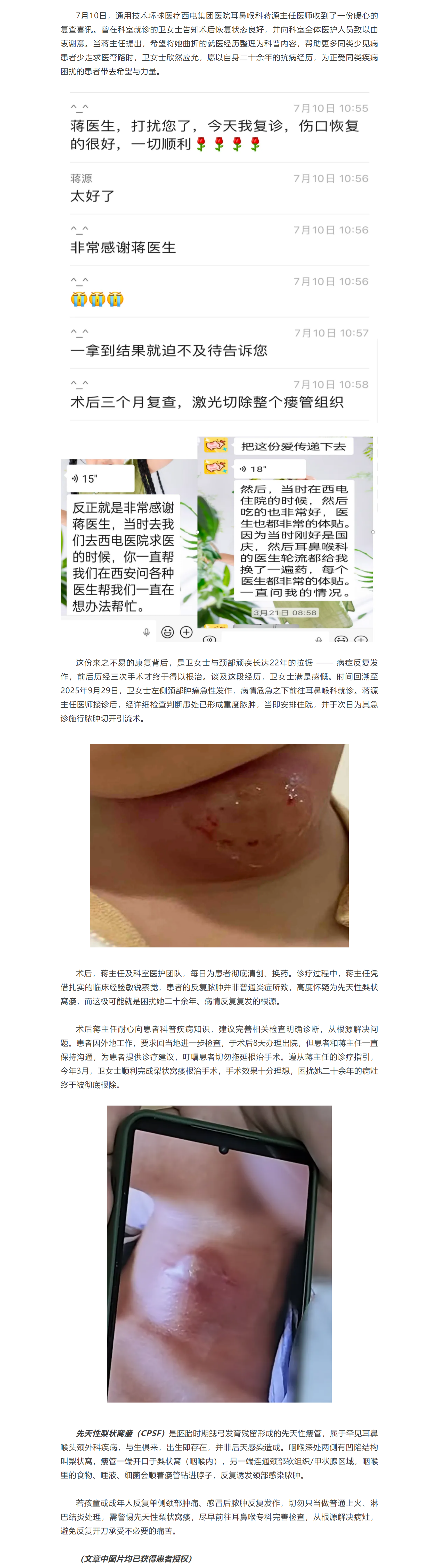 從反復膿腫到徹底根治！西電集團醫(yī)院耳鼻喉科患者自愿分享罕見病就醫(yī)歷程，助力健康科普.png